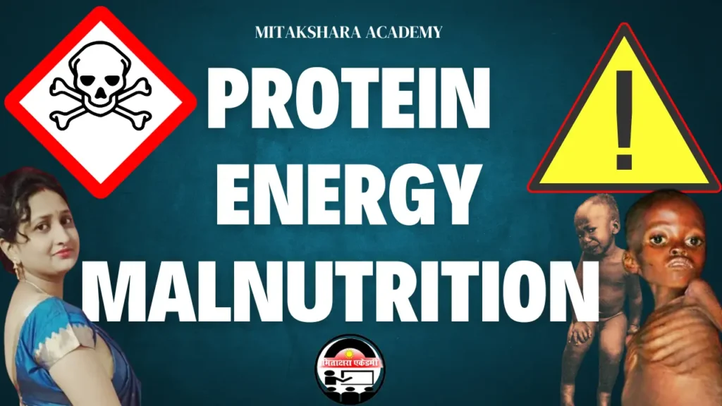 Protein Energy malnutrition